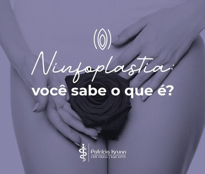 Você já ouviu falar da ninfoplastia?