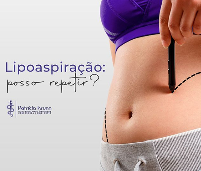 Lipoaspiração, posso repetir?